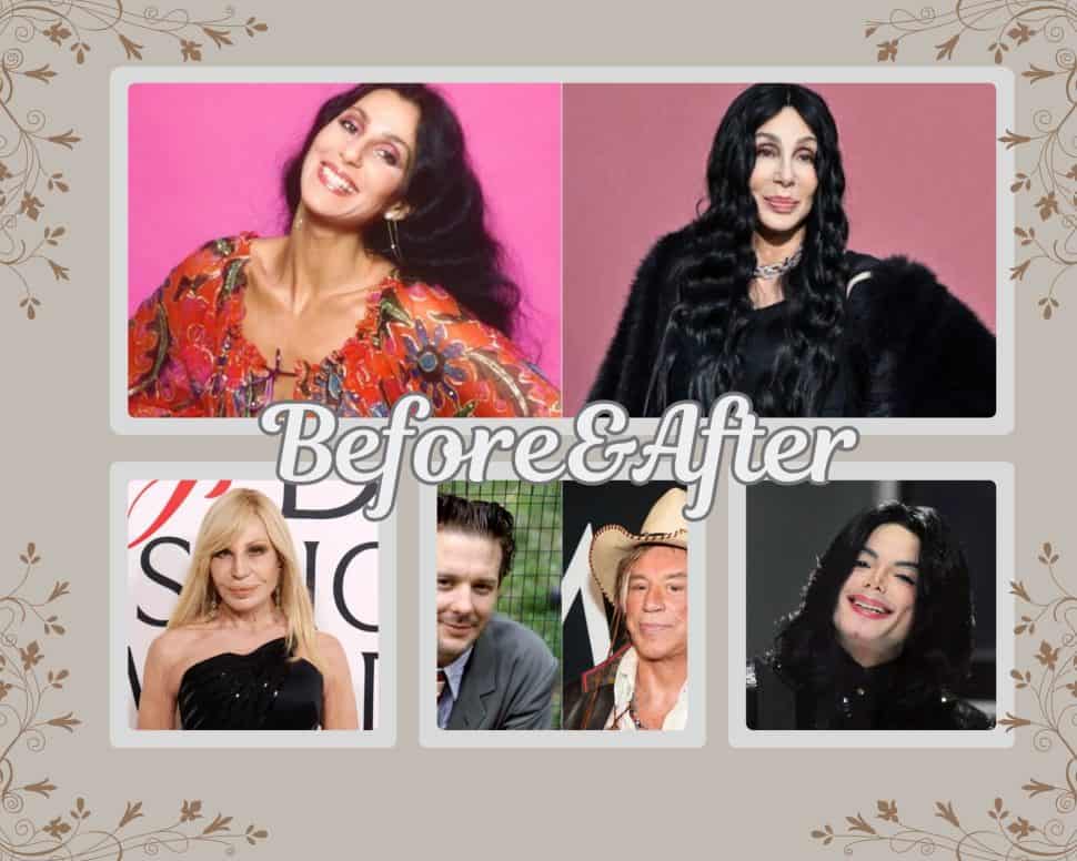 Πριν & Μετά: Οι πιο τραγικές μεταμορφώσεις από πλαστικές επεμβάσεις στην ιστορία του Χόλιγουντ