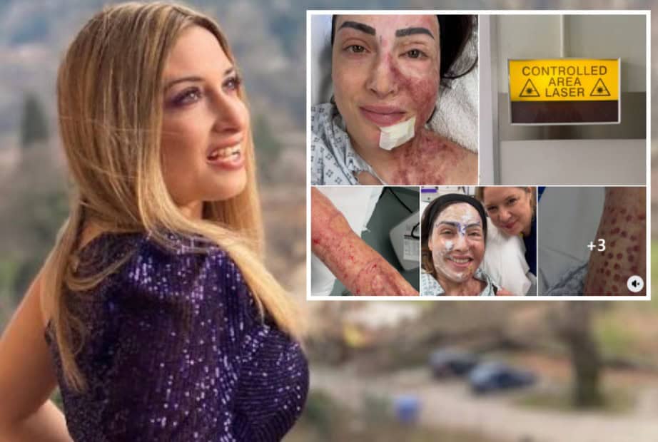 Σοκάρει η Ιωάννα Παλιοσπύρου με φωτογραφίες από την αποκατάστασή της: «Πονάω, αλλά δεν σταματάω – Χτίζω τον εαυτό μου από την αρχή»