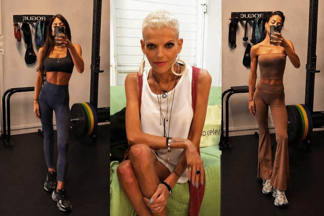 Σάλος μετά τις αποκαλύψεις του Ρακιντζή για τη Δάφνη Καραβοκύρη και την ανορεξία: «Είχα φτάσει 39 κιλά»-Η παρομοίωση με τη Νανά Καραγιάννη