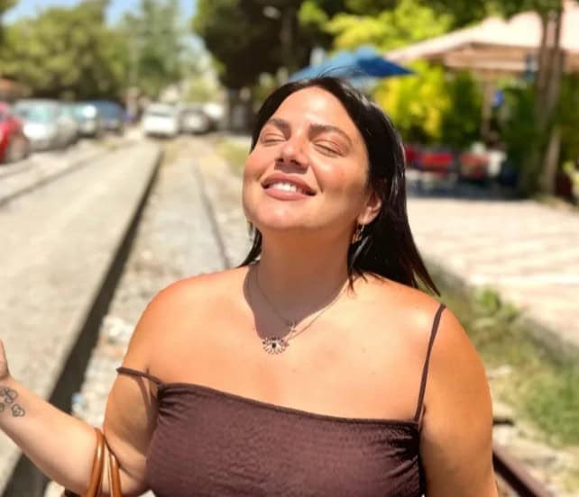 Δανάη Μπάρκα: Τι αποκαλύπτει για την πλαστική στο πρόσωπο – Η νέα της εμφάνιση και η αισθητική επέμβαση