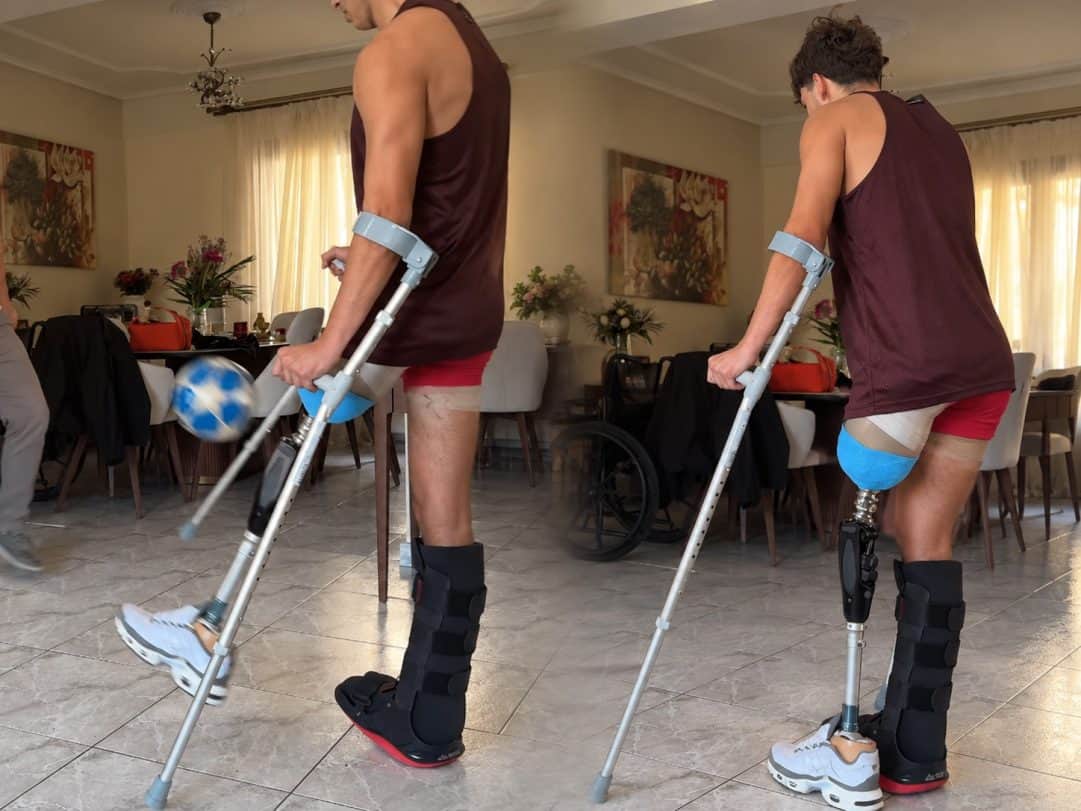 Σταύρος Φλώρος: Δύναμη ψυχής! Δείτε τον να παίζει ποδόσφαιρο με το τεχνητό πόδι (video)