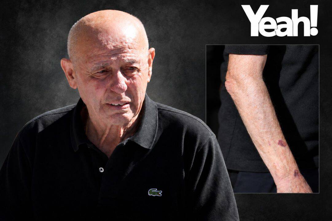 Γιατί έχει σημάδια στα χέρια του ο πατέρας του Μαζωνάκη; Αγωνία για τον κύριο Μανώλη